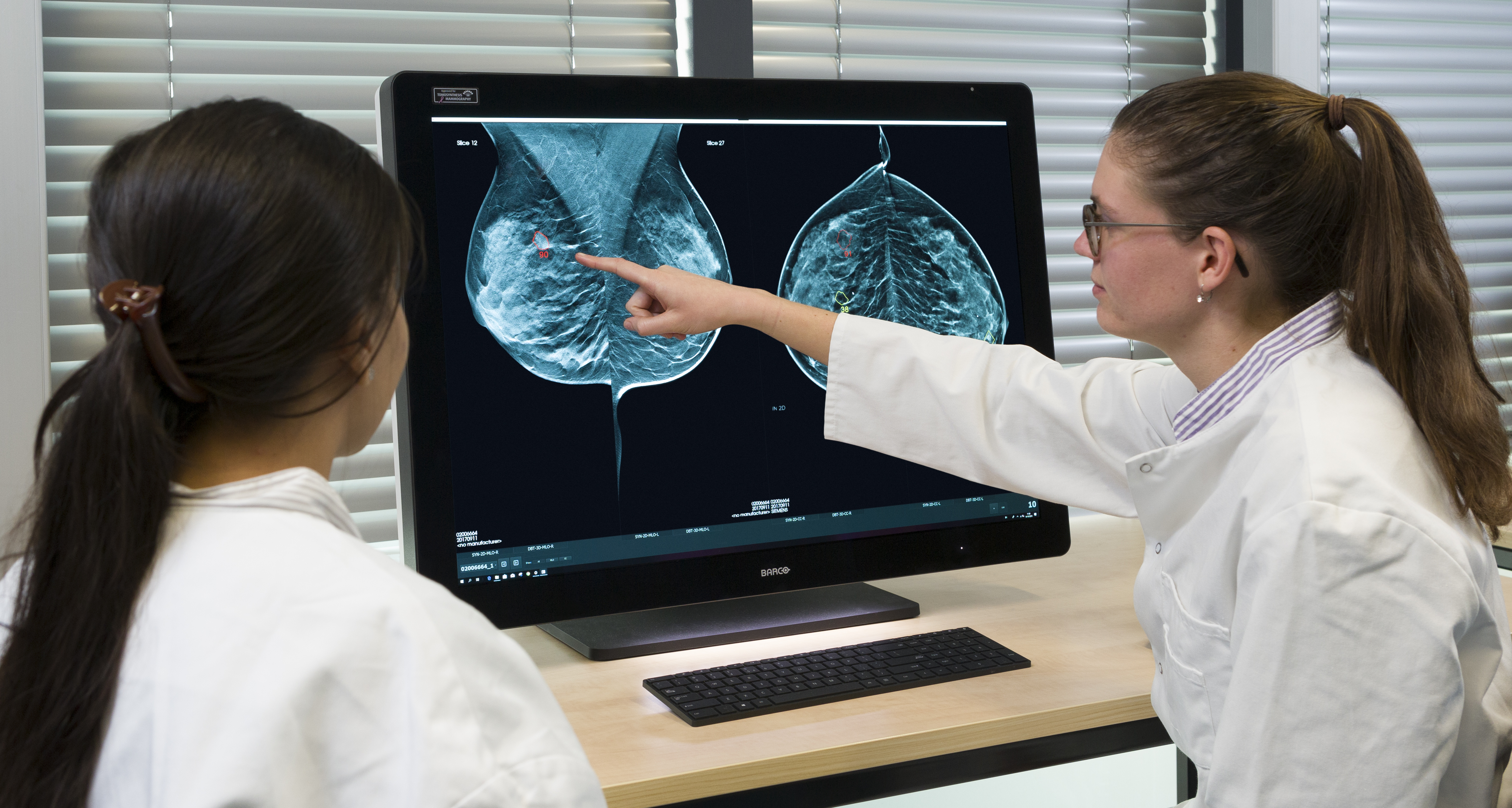 ScreenPoint AI mammogram