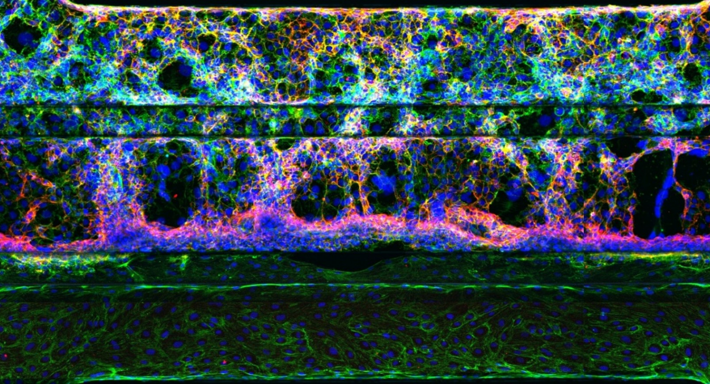 Organ on a chip MIMETAS
