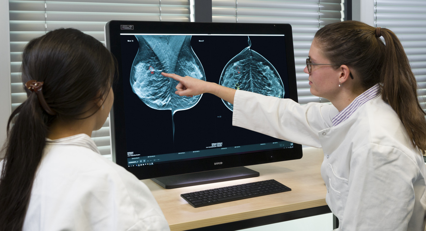 ScreenPoint AI mammogram