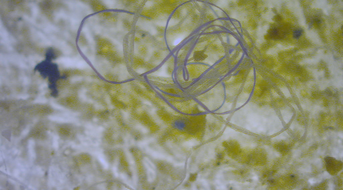 Strand of microplastic Photo: M. Danny